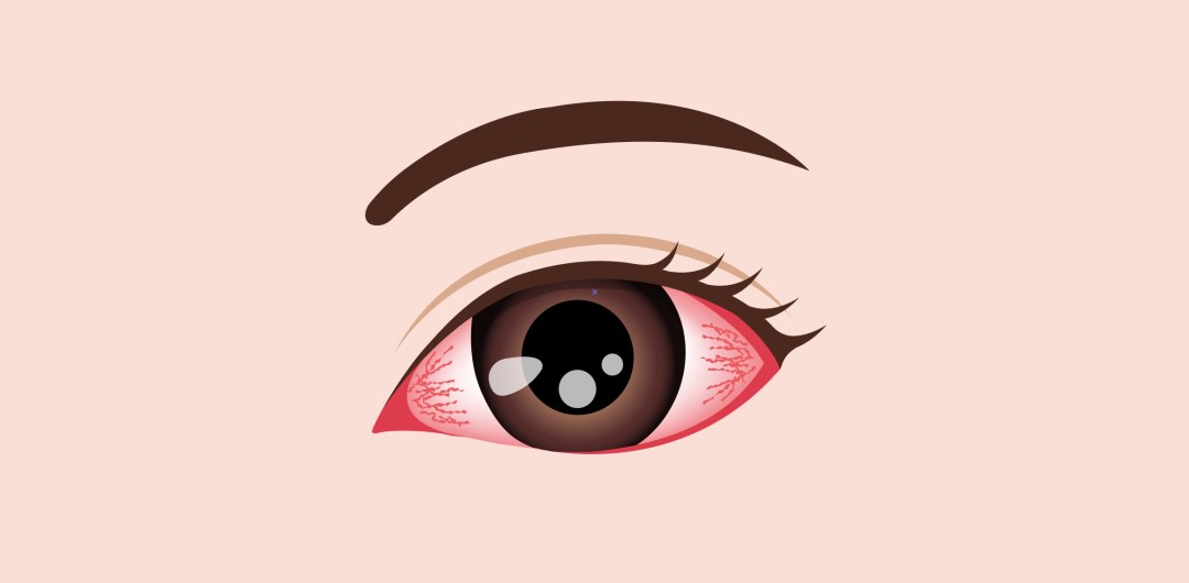 Blog Single